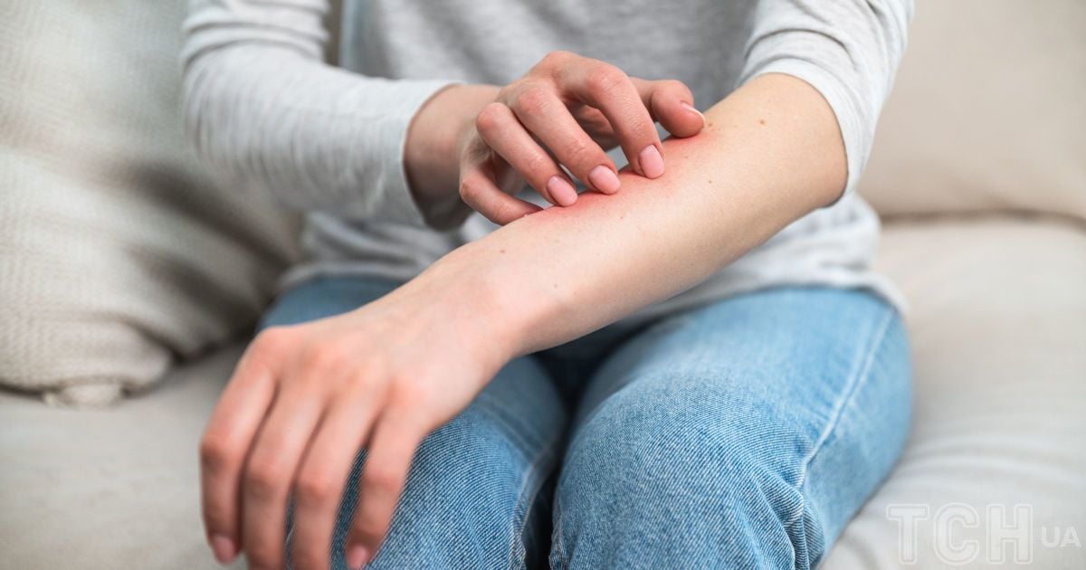 Запалена шкіра