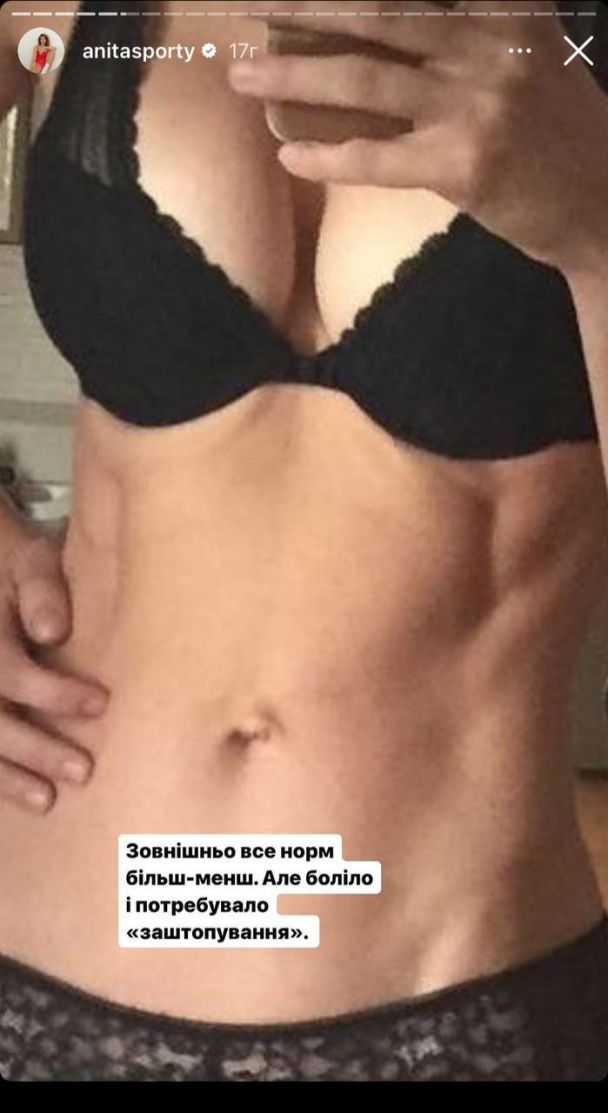 Анита Луценко / © instagram.com/anitasporty