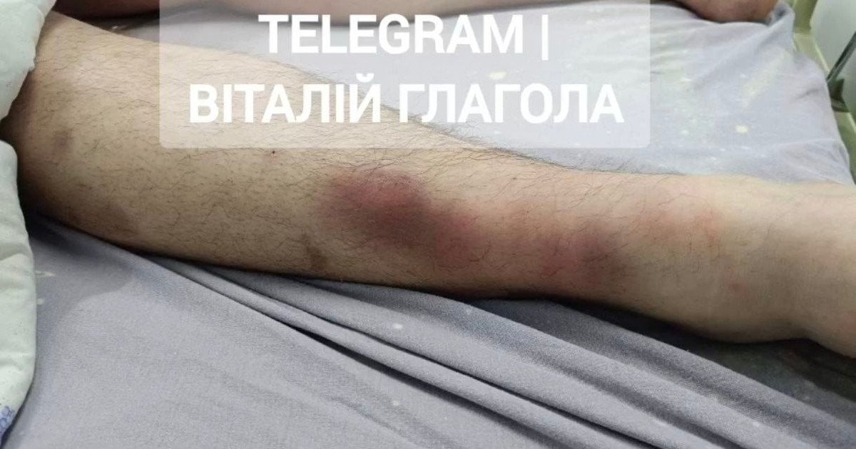 Смерть мобілізованого у ТЦК