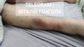 Смерть мобілізованого у ТЦК