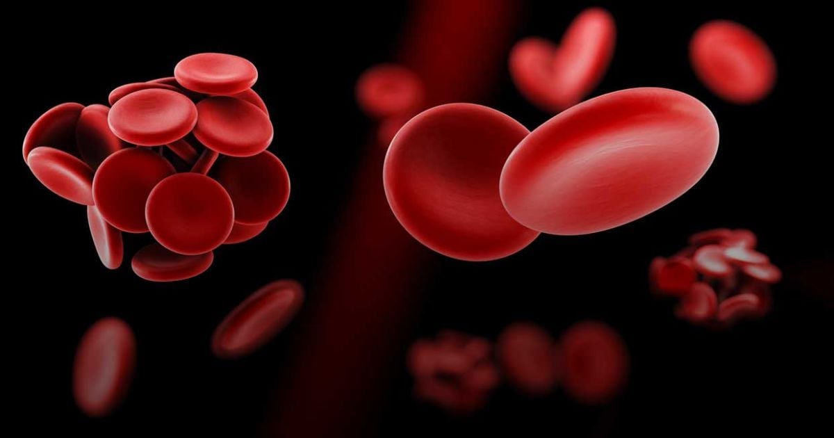 Фрукт, що знизує ризик інсультів