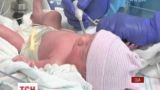 Американские врачи удалили полкилограммовую опухоль у неродившегося младенца