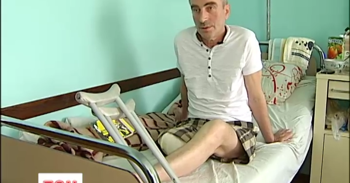Мужчина очнулся в больнице уже без ноги