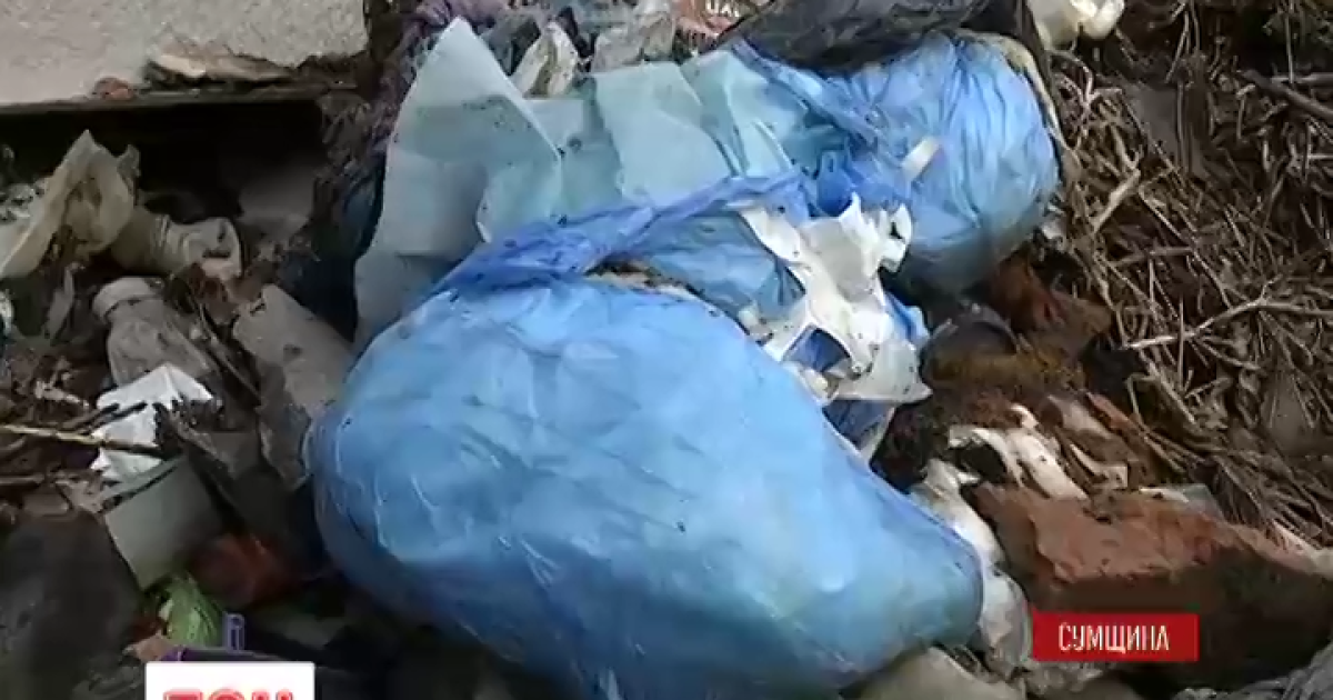 Журналисты разыскали фирму, которая занимается утилизацией обнаруженных на Сумщине конечностей