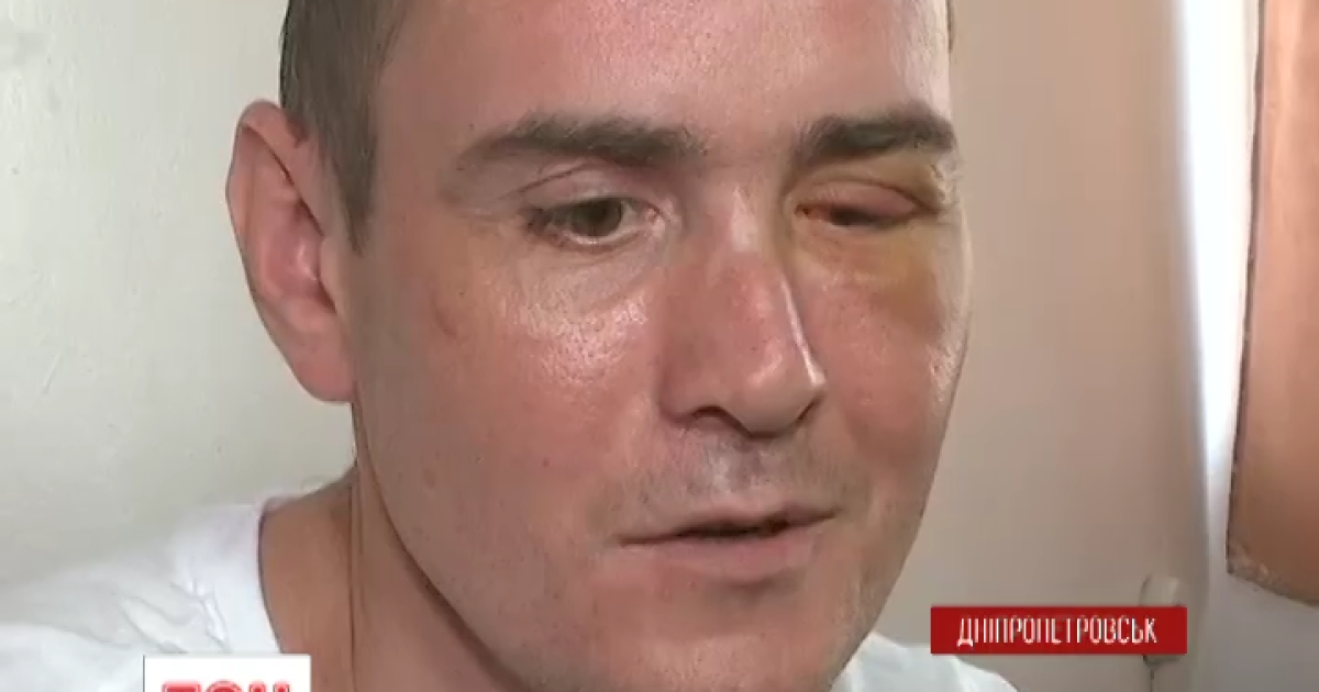 В шаге к смерти. В Днепропетровске бойцу АТО сделали уникальную операцию