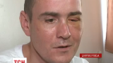 У Дніпропетровську врятували бійця, якому в око влучила куля від автомату