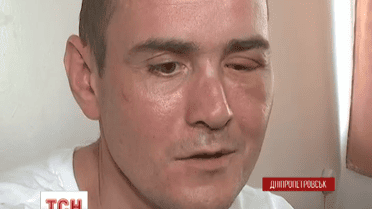 У Дніпропетровську врятували бійця, якому в око влучила куля від автомату