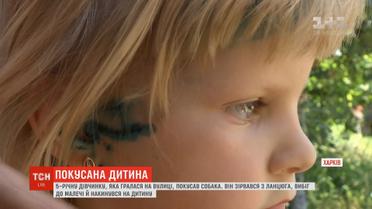 На Харківщині 5-річну дівчинку покусав собака