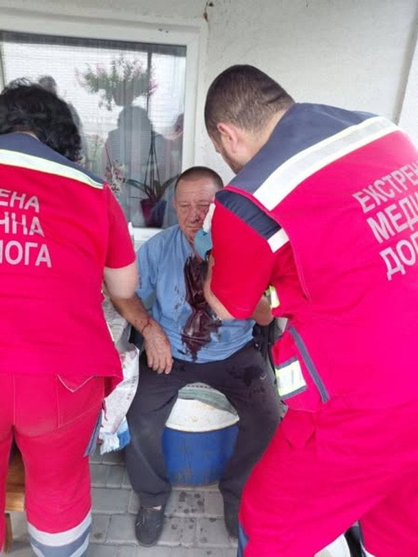 В Киевской области жестоко избили отца погибшего воина: реакция полиции