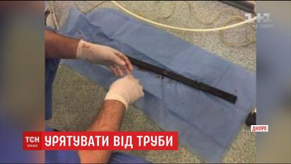 В Днепре спасли мужчину, которого насквозь прошило трехметровой трубой