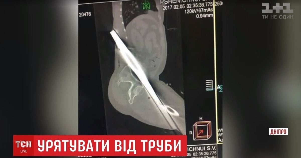 Триметровий металевий профіль проштрикнув водія у ДТП на Дніпропетровщині