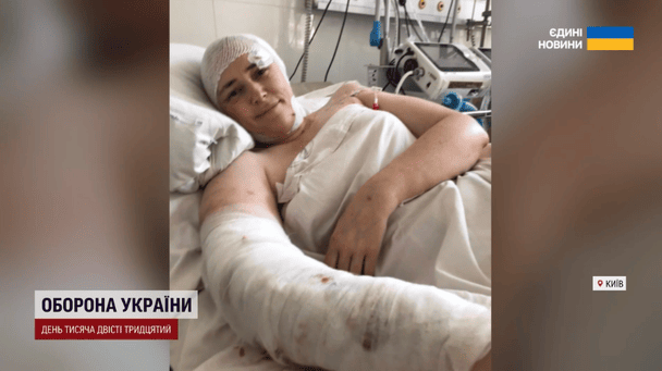 Ольга Бабичева после ракетного удара по Охматдету / © ТСН