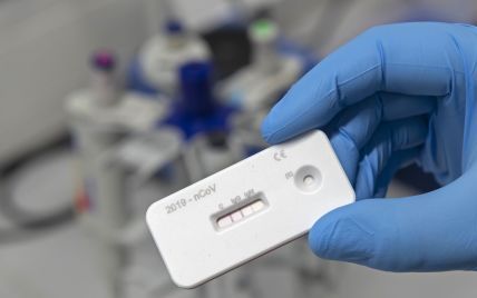 "Результат в течение 30 минут": в Украине планируют открыть мобильные пункты тестирования на коронавирус