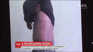 Украинские пленные признались, что их жестоко пытали российские спецслужбы