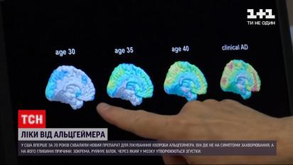Новини світу: у США уперше за 20 років схвалили препарат для боротьби з Альцгеймером