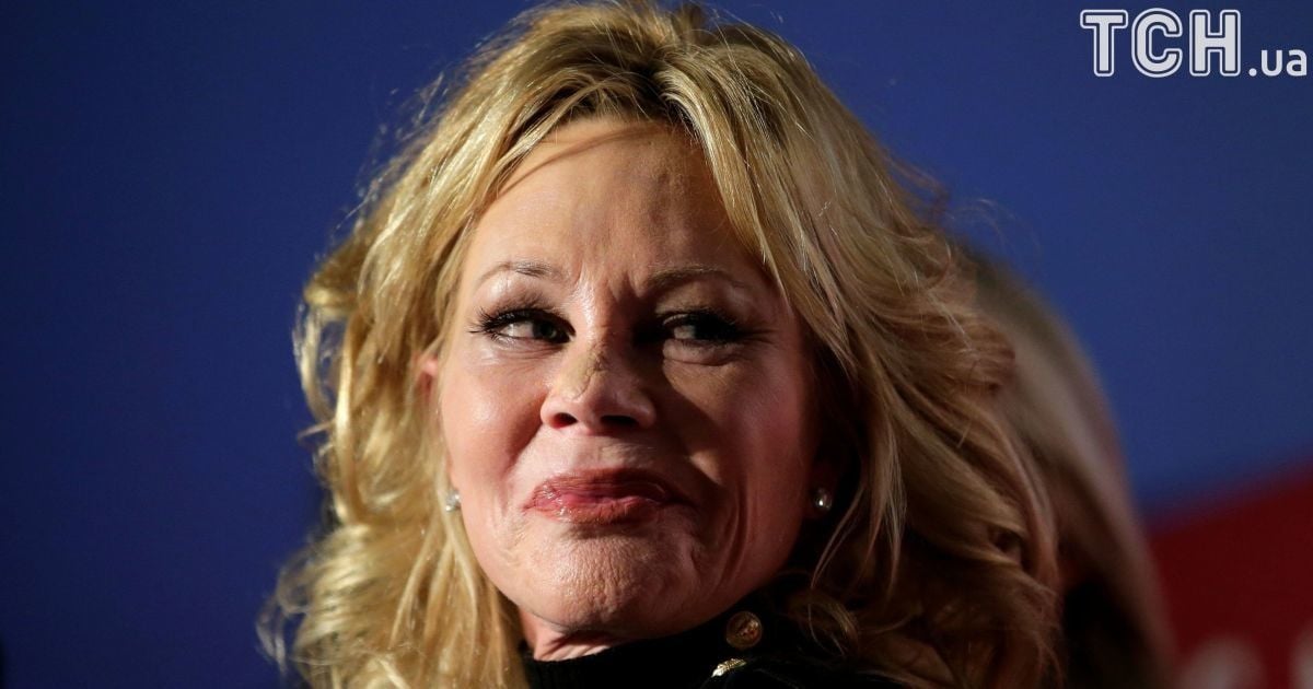 Мелани Гриффит показала последствия удаления опухоли на лице