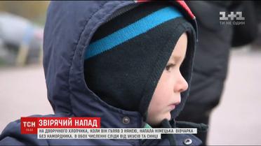 Дворічний хлопчик та няня постраждали під час нападу великої собаки без намордника