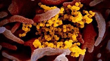 Китайський коронавірус під мікроскопом_3 / © Flickr / National Institute of Allergy and Infectious Diseases
