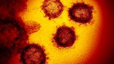 Китайський коронавірус під мікроскопом_2 / © Flickr / National Institute of Allergy and Infectious Diseases
