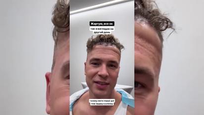 Ведучий Богдан Буше показав, як робив пересадку волосся