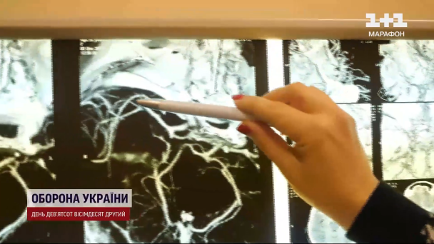 В Україні від серцево-судинних хвороб щороку помирають 400 тисяч людей