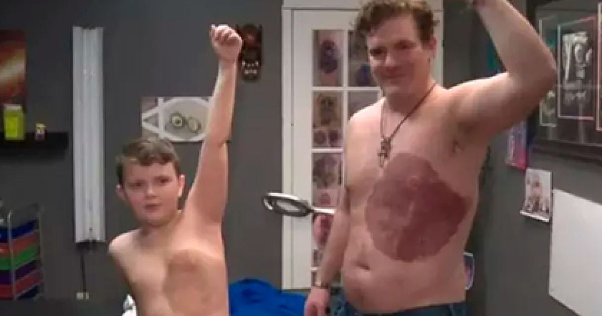 В Канаде мужчине 30 часов набивали татуировки в виде родимого пятна, как у его сына