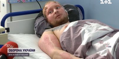 Чудом выжил после ракетного удара по "Ретровилю": что помнит мужчина о том дне
