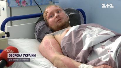 Чудом выжил после ракетного удара по "Ретровилю": что помнит мужчина о том дне