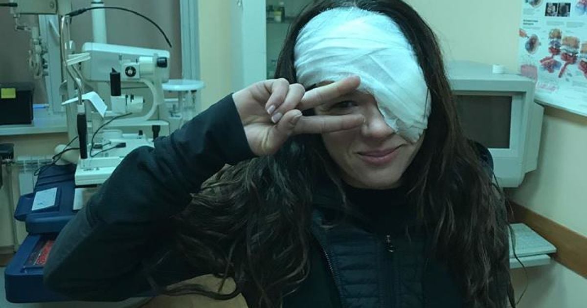 Руслана показала фото з перебинтованим оком