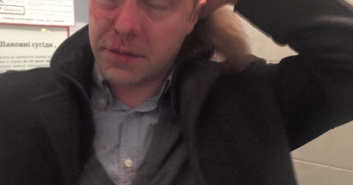 Мірошниченко стверджує, що його побили / © Facebook/Ігор Мірошниченко
