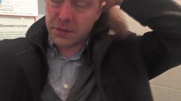 Мірошниченко стверджує, що його побили / © Facebook/Ігор Мірошниченко