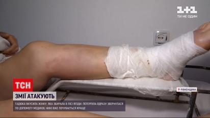 Новини України: в Рівненській області жінку вкусила гадюка в лісі