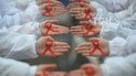 "Тиха епідемія": конфлікт на Донбасі сприяв поширенню ВІЛ-інфекції - дослідження