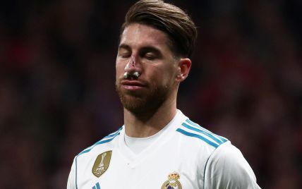 Захисник "Реала" після перелому носа гратиме у захисній масці