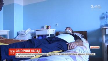 Едва уцелевший после нападения питбуля мужчина говорит, что команду о нападении дал владелец животного