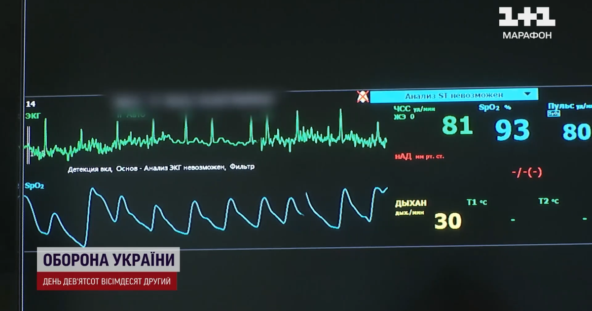 Медики розповіли про серцеві захворювання