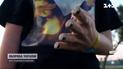 В США бесплатно протезировали 9-летнюю украинку