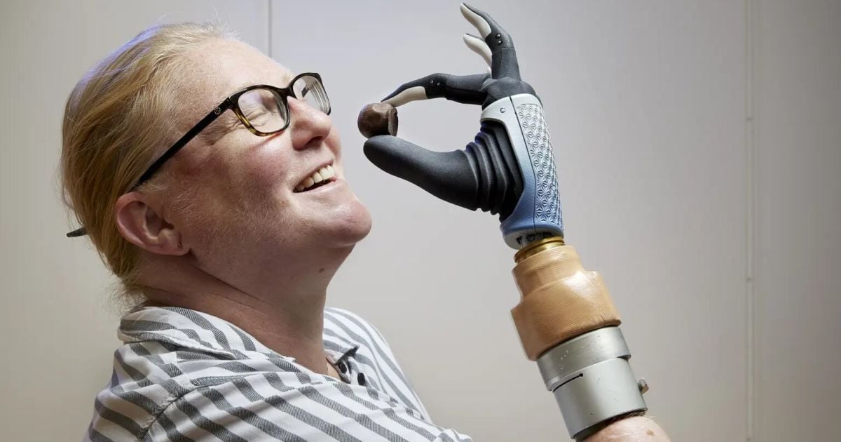 Женщина с интеллектуальным протезом / Фото: Anna-Lena Lundqvist/Ortiz-Cata SWNS