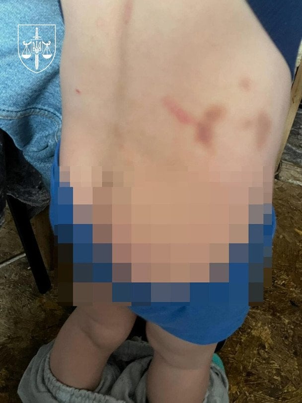 Сліди насильства над дітьми / © Прокуратура Київської області