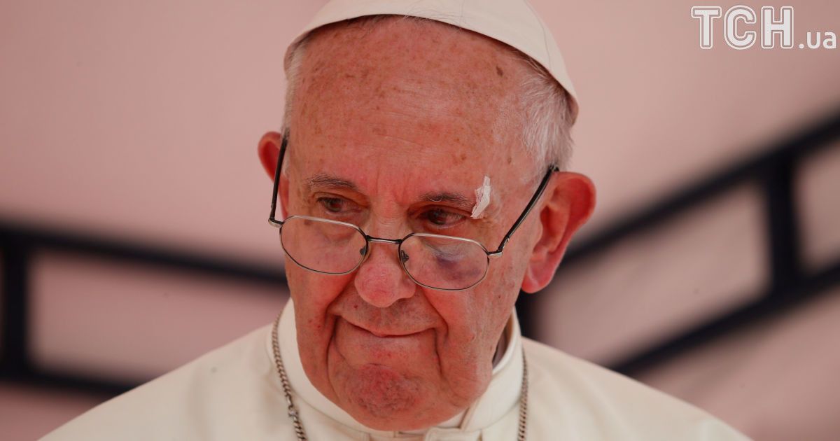 травмований Папа Римський_4 / © Reuters