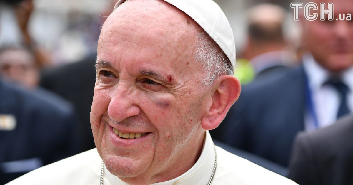 травмований Папа Римський_2 / © Reuters