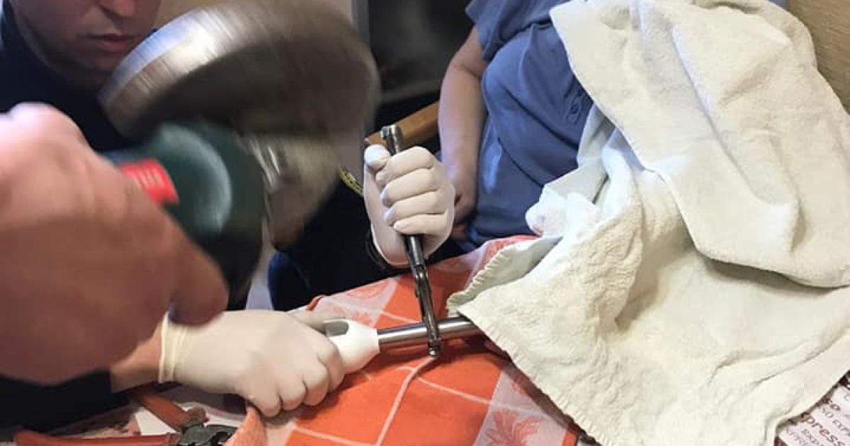 У Києві жінка засунула пальці до насадки ручного блендера