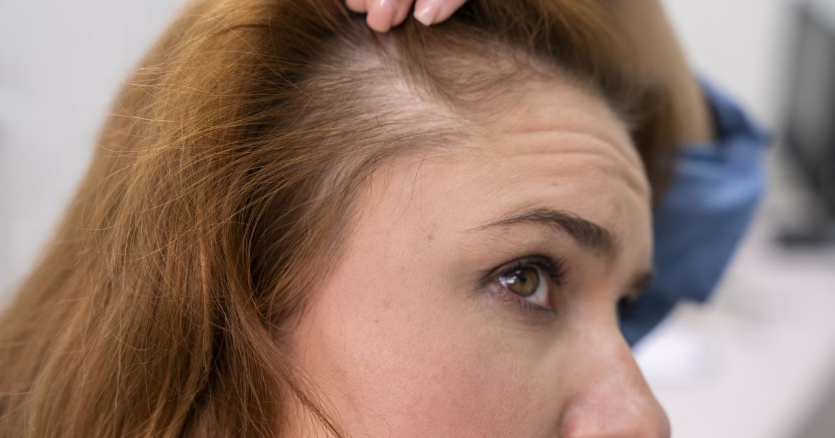 Чем может помочь шампунь против выпадения волос?