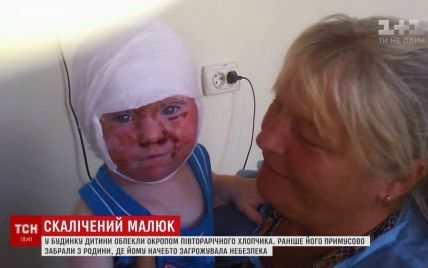 На Кіровоградщині у будинку дитини вихователька вилила окріп на півторарічного малюка