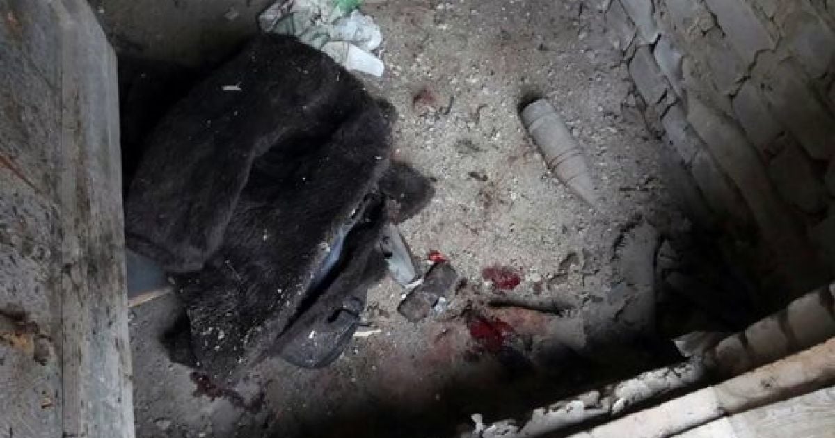 На Харківщині у чоловіка просто у руках вибухнув бронебійний снаряд
