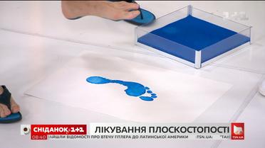 Чим небезпечна плоскостопість і чи можна її вилікувати