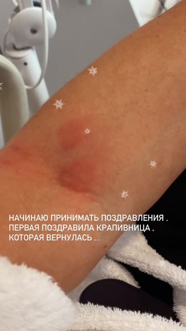  / © instagram.com/annasedokova