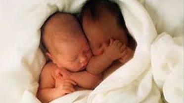 Незвичні близнюки (без коментарів. Reuters)