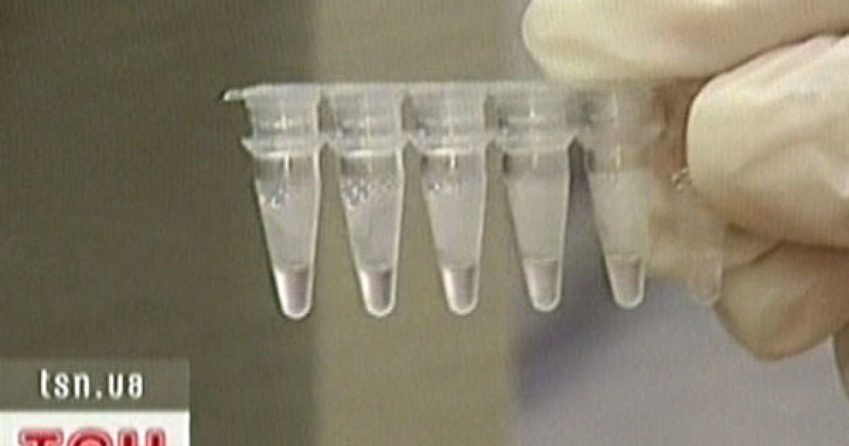 У цей день народилася перша людина, зачата у пробірці.