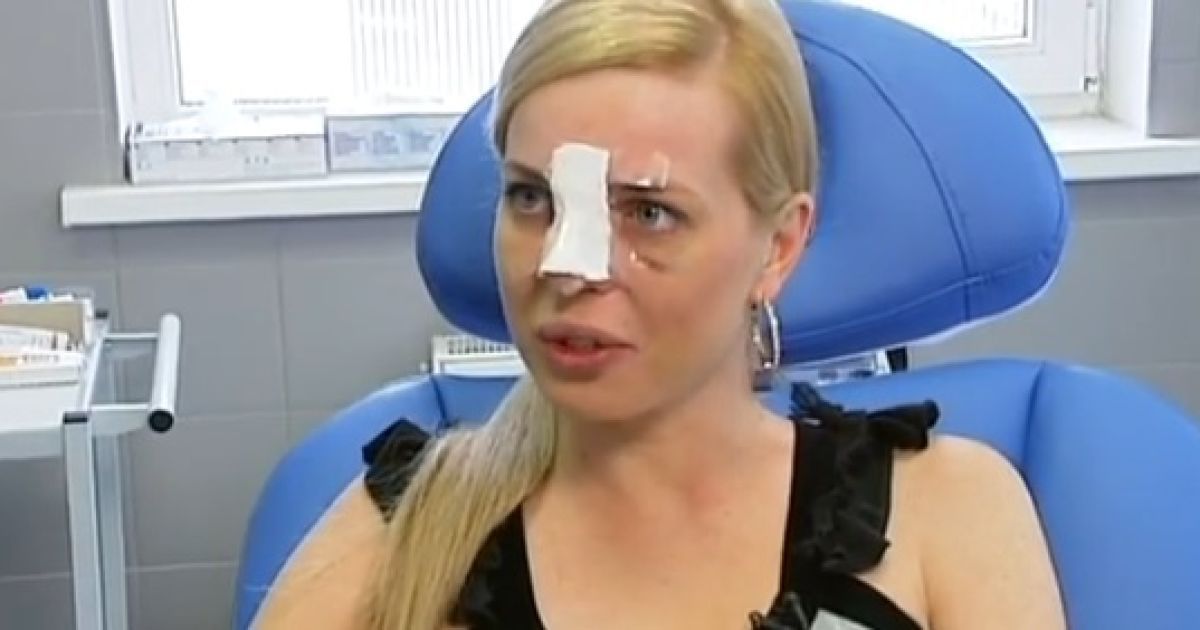 Стребкова "підрихтувала" ніс у клініці Іскорнєва
